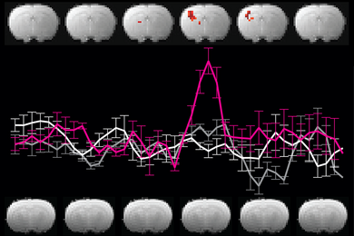 Two rows of MRI brain scans with a line graph in between. Several scans show small blobs of red. In the graph there is a spike corresponding to the brain scan with the largest red spot