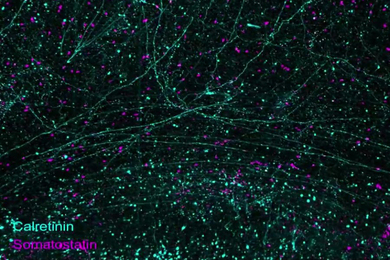 Hundreds of brain cells stained in magenta (labeled TK) and cyan (labeled calretinin) on a black background. Long branches of many of the neurons stretch across portions of the frame.