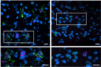 Two panels show blue cells on a black background. Some cells have magenta and green speckles. Below, each panel two subpanels show magnified views.