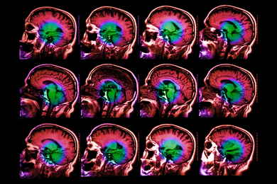 A grid shows 12 colorful brain scans on black background.