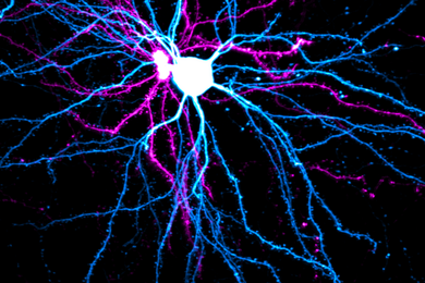 Microscopic image of neurons in different colors, against a black background.