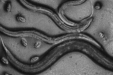 Grayscale image of nematode worms under a microscope