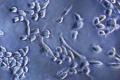 Micrograph of cells shown up close on a polymer composite