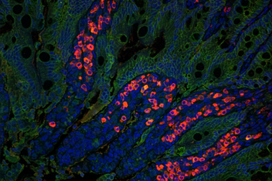 Intestinal cells show red spots in microscopic view