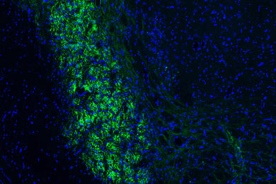 Bright green cells form a column against dark blue background cells as seen under a microscope