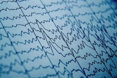 Closeup up paper displaying dark blue traces of many squiggly brain waves as they run across the page