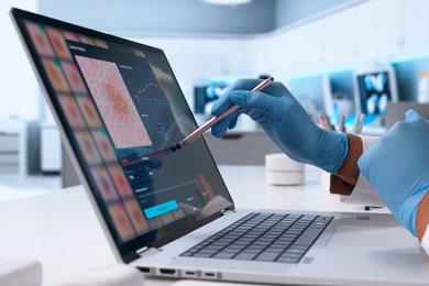 A clinician looking at images of skin disorders on a computer