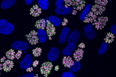 Micrograph: Clusters of parasites (like rings of oval beads) near large blue organelles