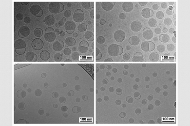Micrograph of lipid nanoparticles