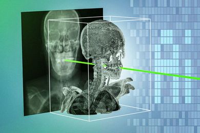 A flat 2D Xray scan of skull is behind a 3D rendering of the skull, with a laser going through them. Background says “AI.”
