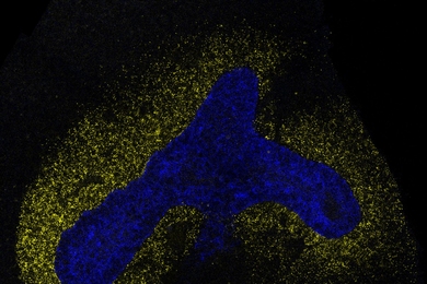 Microscopic image of cells stained blue in a boomerang-like shape, surrounded by cells stained yellow, all on a black background