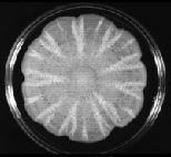 A yeast culture that Dr. Todd Reynolds grew in a Jello-like medium spreads out, forming beautiful floral patterns. Yet when the same yeast was grown on plastic, it formed biofilms, which are potentially dangerous.
