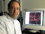 Mark Bear (above, with an image of a neuron on his computer monitor) has done research that implicates a single mutated gene and protein in the many symptoms of fragile X syndrome.