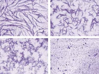 In the upper left, amyloid fibers at first resist any attempt to disrupt their structure. Hsp104, however, breaks them apart until, bottom right, they have been completely dissolved.