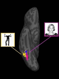 By increasing the resolution of brain scans, MIT scientist Nancy Kanwisher and colleagues have shown that brain regions that specialize in  recognizing faces (pink area) and those that specialize in bodies (yellow area) are close but distinct.