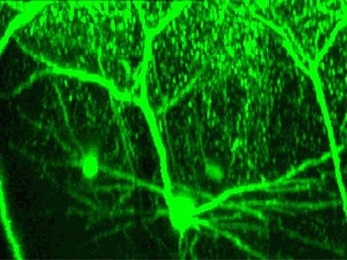 View of a pyramidal neuron within the cerebral cortex of a living mouse brain.