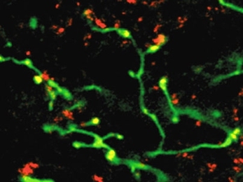 This confocal microscopy image shows activity in the rat brain, with the retinal nerve pathway showing green and the functional synapses appearing yellow.
