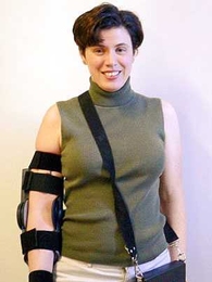 Maggie Fermental, a stroke survivor and study participant, regained full motion at the elbow after 18 hours using the device and has maintained her progress to date. <a onclick="MM_openBrWindow('brace-standing-enlarged.html','','width=509, height=583')">
<span onmouseover="this.className='cursorChange';">Open image gallery</span>
</a>
<noscript> <a href="brace-standing-enlarged.html">
<em>(no ...