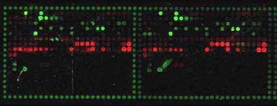 These peptide arrays--glass slides covered with thousands of tiny protein fragments--were used to observe the formation of the long fibers key to certain neurodegenerative diseases.