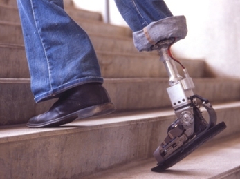 The robotic ankle is one of six MIT inventions singled out by Time magazine in its annual survey of the world's most promising visions of the future. MIT Media Lab Professor Hugh Herr and his team of researchers developed the world's first such ankle, an important advance for lower-limb amputees. <a onclick="MM_openBrWindow('time-ankle-enlarged.html','','width=509, height=583')">
<span onmouseove...