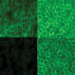 These images show macrophages infected with anthrax. The fluorescent green areas indicate the presence of nitric oxide (NO). In the top two panels, the anthrax can produce NO. At top left, an image taken two hours after infection shows that NO is present. At 18 hours, top right, more NO is present, produced by the macrophages. In the bottom two panels, the anthrax infecting the macrophages is unab...