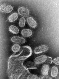 This transmission electron micrograph (TEM) shows the 1918 influenza virus, which CDC researchers re-created in 2005.