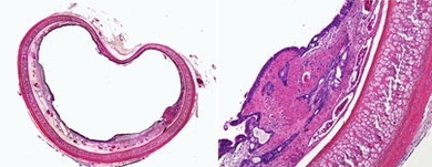 Cross-section and close-up of a rabbit trachea whose inner lining has been damaged.