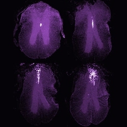 Coronal sections of injured adult spinal cord, anterior to posterior. The labelling shows recombined ependymal cells and their progeny (white) migrating out to the injury area in the dorsal funiculus, as a reponse to the injury (injury is in the image on the right hand corner). The mouse is a FoxJ1-CreER x R26R-LacZ reporter.