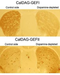 The Graybiel Lab caused Parkinson's disease in rats by depleting dopamine in the right side of the striatum, the brain region that drives the abnormal movements in the disease, leaving the left side as the control. Treating the rats with L-DOPA induced dyskinesia...