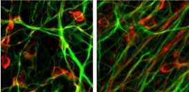 Whitehead Institute researchers reprogrammed human skin cells from Parkinson's disease patients into an embryonic-stem-cell-like state. After removing the reprogramming genes, the scientists used these so-called induced pluripotent stem (iPS) cells to create dopamine-producing neurons, the cell type that degenerates in Parkinson's disease patients.Â To confirm that the iPS cells had become dopam...