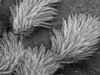 Cilia inside the human trachea. Scanning electron micrograph.