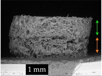 MIT and Cambridge University scientists developed this tissue scaffold that could help repair knees and other joints. The top section, indicated by the green arrow, stimulates bone growth, while the lower half, marked by the orange arrow, stimulates cartilage growth.