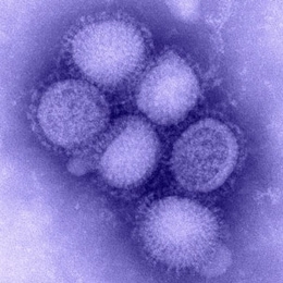 An image of the H1N1 influenza virus taken in the CDC Influenza Laboratory.