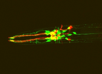 C. elegans expressing red fluorescent protein in dopamine neurons and green fluorescent protein in dopamine receptor-expressing neurons.