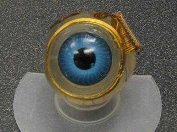 A model of the retinal implant: The coil that surrounds the iris receives visual data from a camera mounted on a pair of glasses. The coil sends the images to a chip attached to the side of the eyeball, which processes the data and sends it to electrodes implanted below the retina.