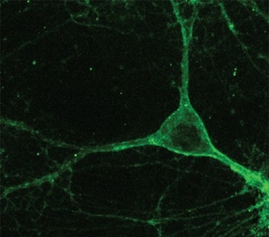 Mouse neuron expressing Arch gene