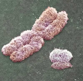 The Y chromosome, right, is dwarfed by the much larger X chromosome.