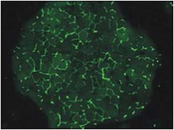 Liver cells in a micropatterned co-culture form tube-like structures (shown here in green) that resemble bile capillaries found in a human liver.