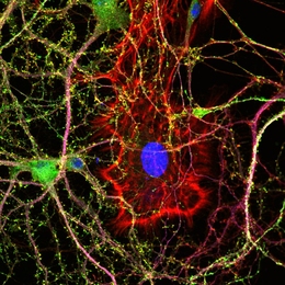 MIT neuroscientists have shown that the protein Arc is necessary for neurons like this one to adjust their responses to new sensory stimuli. (The blue circle is the neuron’s nucleus, and the red strands are actin filaments.)