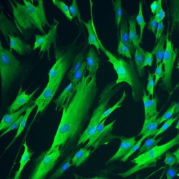 MIT researchers used RNA to induce these fibroblast cells to express four genes necessary to reprogram cells to an immature state.