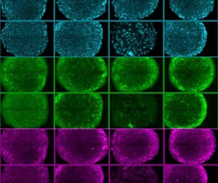 This image shows rows of human embryonic stem cells that MIT researchers grew on a new synthetic surface. The cells at top (blue) are stained to reveal their nuclei, while the cells in the middle and bottom are stained for proteins that are known to be present when cells are pluripotent.