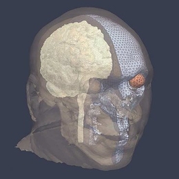 This image shows the detailed anatomical features of the brain that Radovitzky and his colleagues analyze using models that simulate explosive blasts.