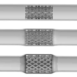 A computer simulation based on the numerical modeling carried out by Vikas Srivastava, Shawn Chester and Lallit Anand shows how a stent made of shape-memory polymer would look as it undergoes a transition inside the body from a compressed shape, used for inserting it into position, to its fully extended original shape.