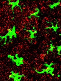 Immune cells, tagged with green fluorescent protein, are surrounded by nanoparticles (red), after the nanoparticles are injected into the skin of a mouse.