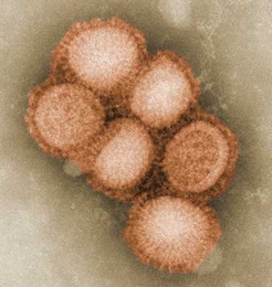 An image of the H1N1 influenza virus taken in the CDC Influenza Laboratory.