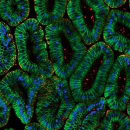 Shown here are mouse intestinal epithelial cells. MIT and MGH researchers have modeled how such cells respond to tumor necrosis factor
