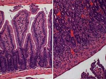 The image at left shows tissue from the small intestine of a mouse infected with type II parasites that transgenically expresses the type I ROP16. At right, in a mouse infected with Toxoplasma gondii, the intestines are inflamed and have lost much of their normal structure.

