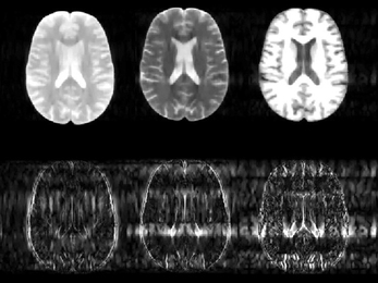 Two by three grid of brain scans