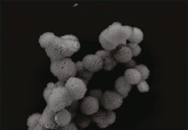 A cluster of microsponges made of long strands of folded RNA, as seen by scanning electron microscopy.