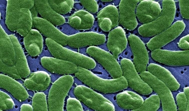 A scanning electron micrograph (SEM) of a grouping of Vibrio vulnificus bacteria.